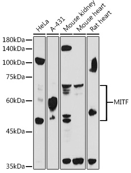 MITF Antibody