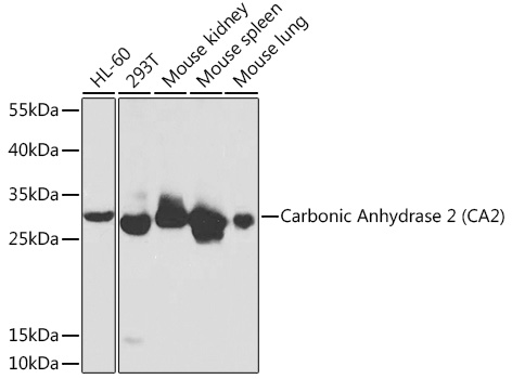 CA2 Antibody