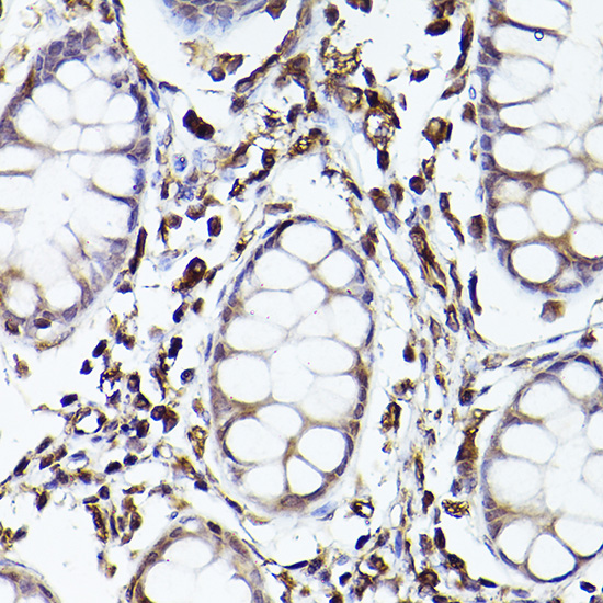 TLR8 Antibody