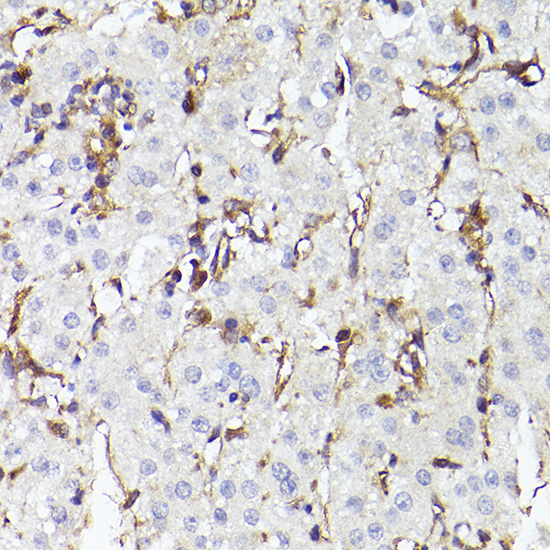 TLR8 Antibody