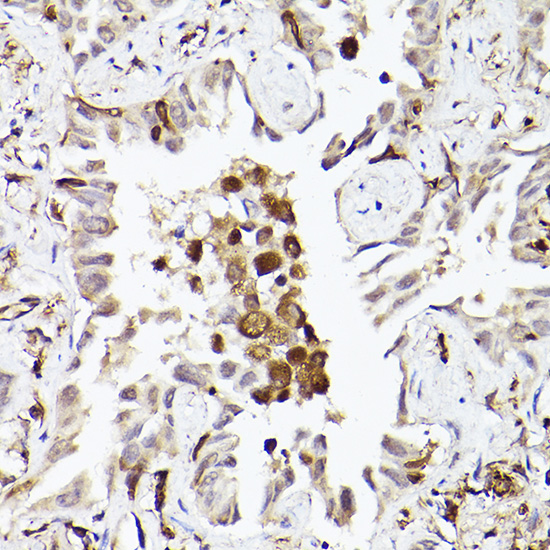 TLR8 Antibody