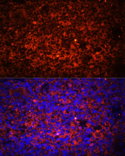 TLR8 Antibody