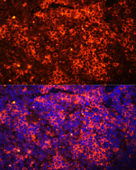 TLR8 Antibody