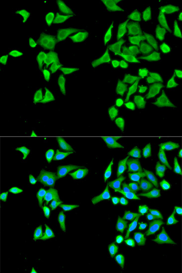 CES2 Antibody