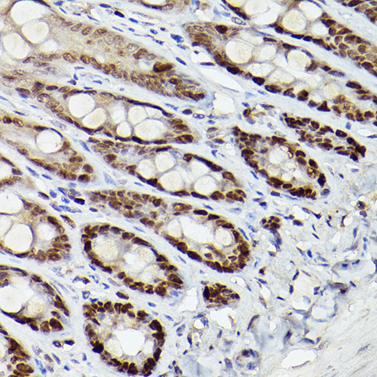 HDAC9 Antibody