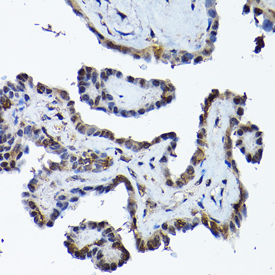 PRMT5 Antibody