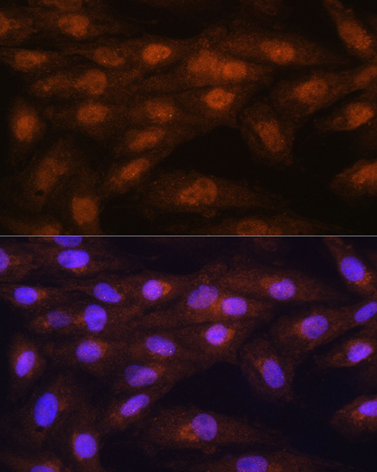 PRMT5 Antibody