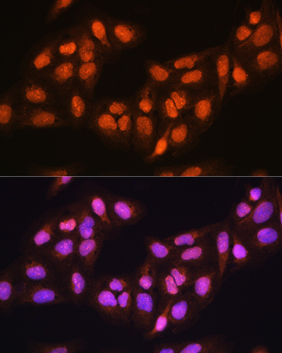 PRMT5 Antibody