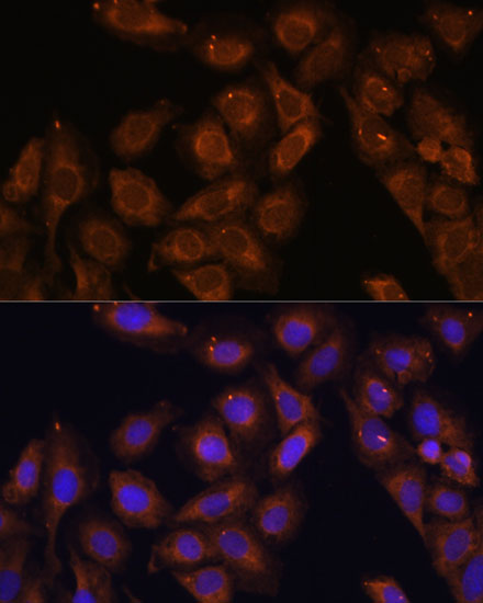 UPF1 Antibody