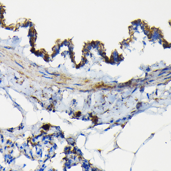 TNF-R1 Antibody