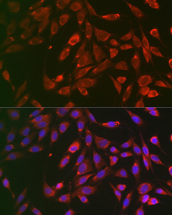 TNF-R1 Antibody