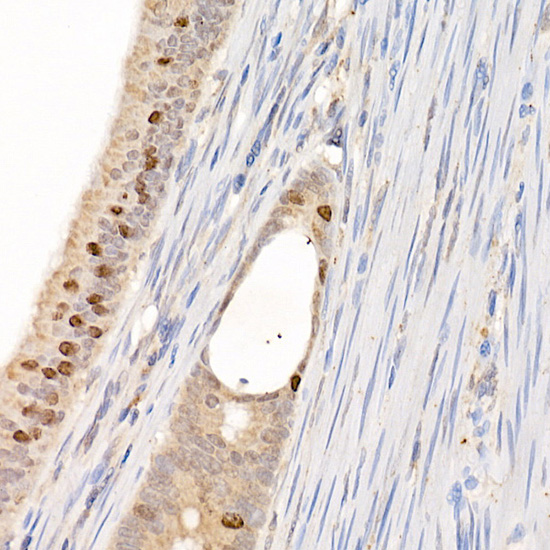 BIRC5 Antibody