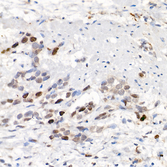 BIRC5 Antibody