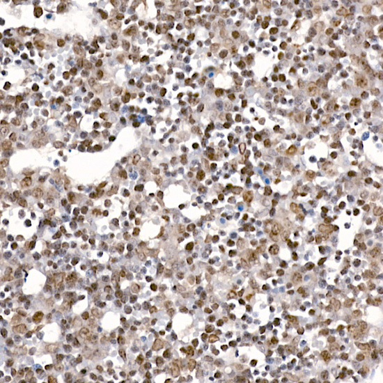 BIRC5 Antibody