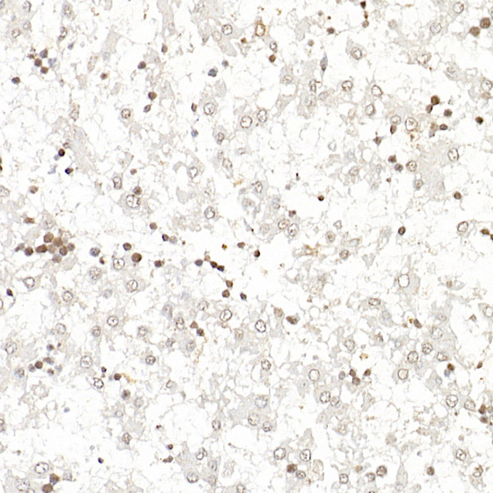 BIRC5 Antibody