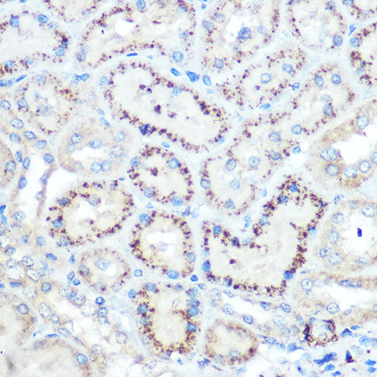 TIMP2 Antibody