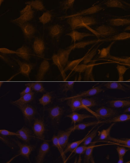 TIMP2 Antibody