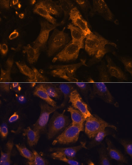 TIMP2 Antibody