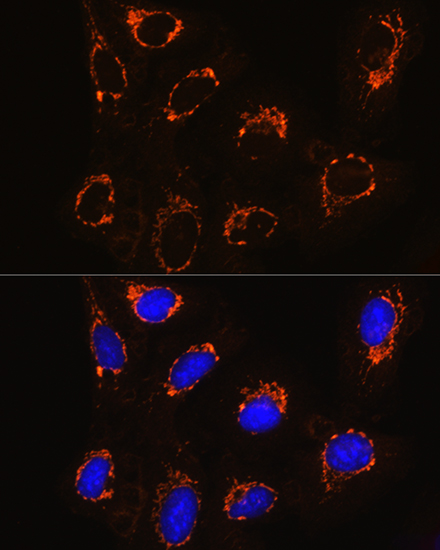 MAOB Antibody