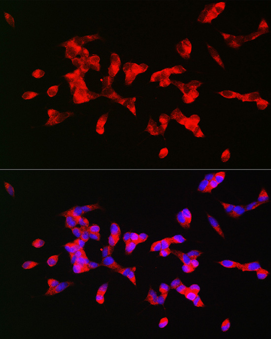 CHRM1 Antibody