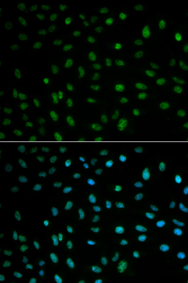 ELAVL1 Antibody