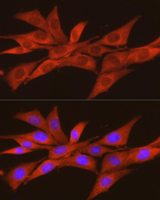 CSNK2A2 Antibody