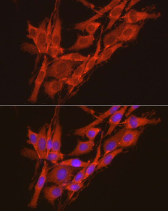 CSNK2A2 Antibody