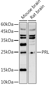 PRL Antibody