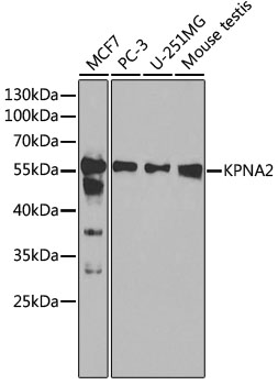 KPNA2 Antibody