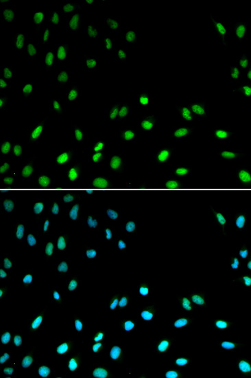 RFC1 Antibody