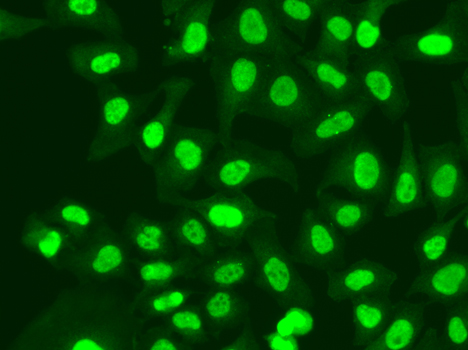 RFC1 Antibody