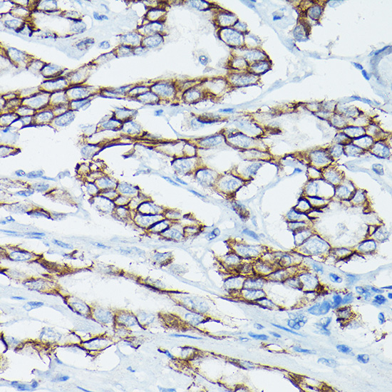 CTNND1 Antibody