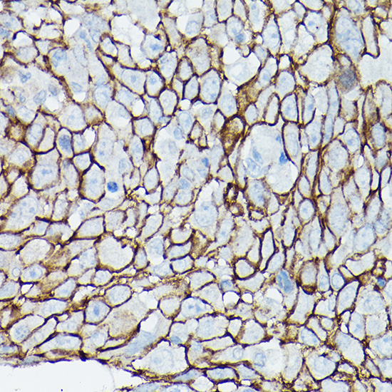 CTNND1 Antibody