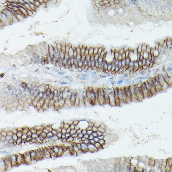 CTNND1 Antibody