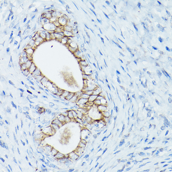 CTNND1 Antibody