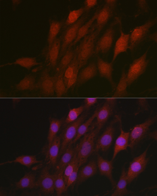 BTRC Antibody