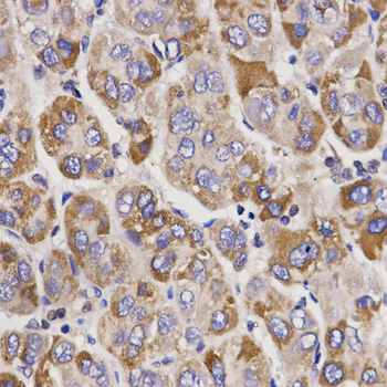 UGT1A9 Antibody