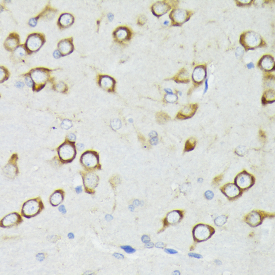 PDPK1 Antibody