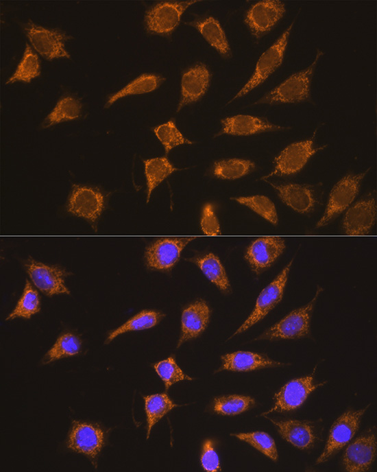 KNG1 Antibody