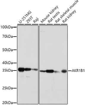 AKR1B1 Antibody