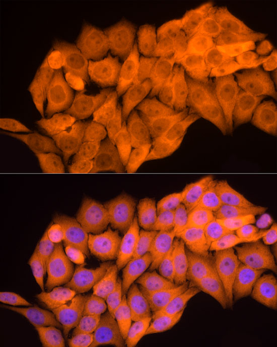 AKR1B1 Antibody