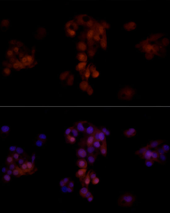 AKR1B1 Antibody