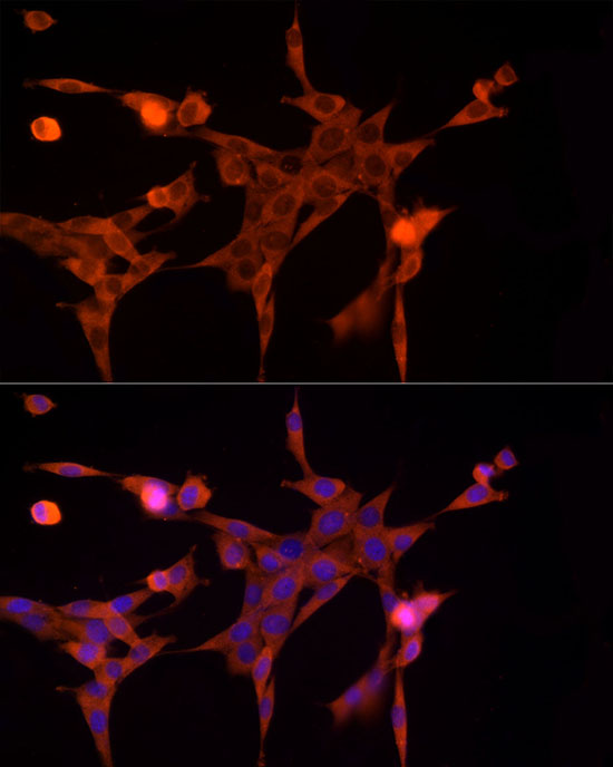 AKR1B1 Antibody