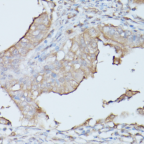 CEACAM1 Antibody