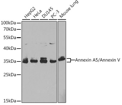 ANXA5 Antibody