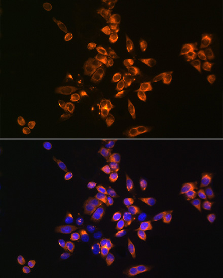 ANXA5 Antibody