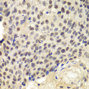 KPNA1 Antibody