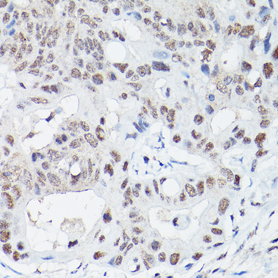 LIG4 Antibody