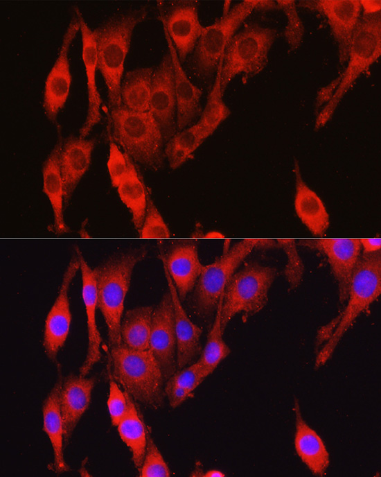 VCL Antibody