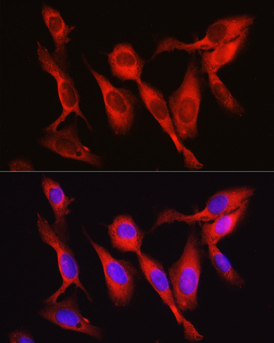 VCL Antibody